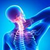 Причины, симптомы и лечение шейного остеохондроза в домашних условиях