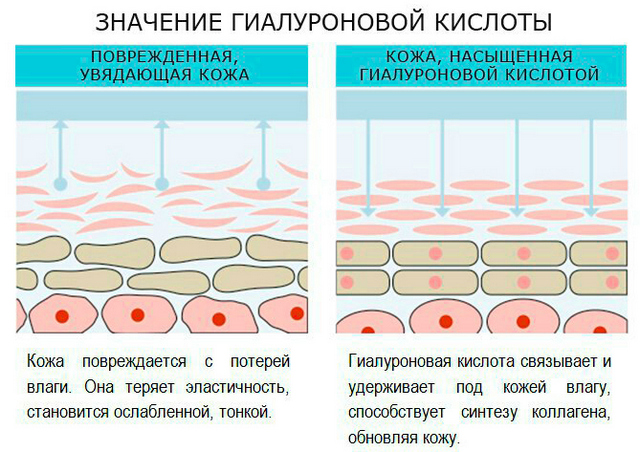 зачем нужна гиалуроновая кислота