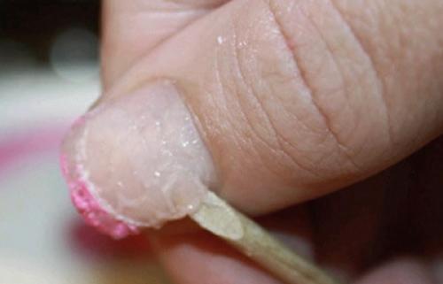 Чем снять биогель с ногтей в домашних условиях. Как и зачем нужно снимать биогель с ногтей