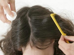 Чем вывести гниды в волосах