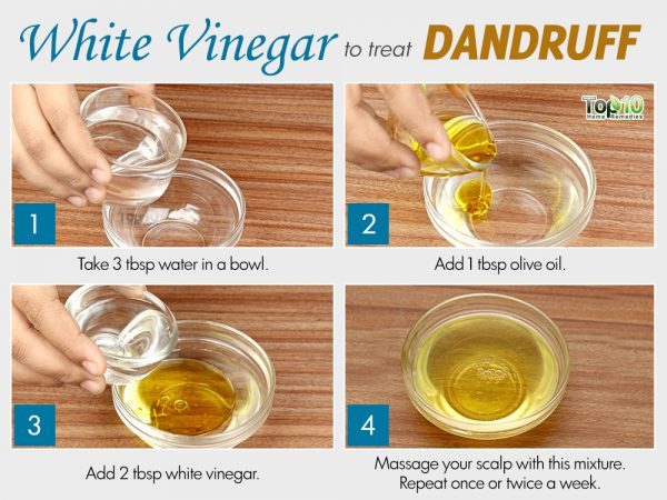 white vinegar for dandruff
